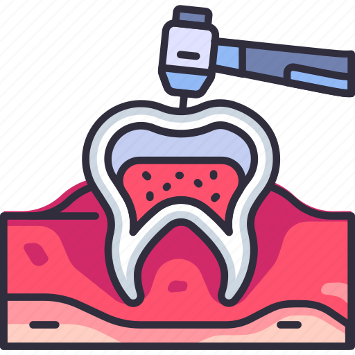 Dentistry, dental, dentist, drilling, treatment, gum, cleaning icon - Download on Iconfinder