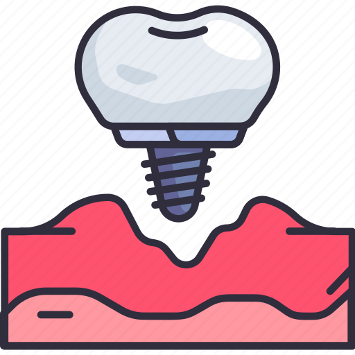 Dentistry, dental, dentist, implant, surgery, gum icon - Download on Iconfinder