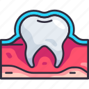 dentistry, dental, dentist, tooth enamel, anatomy, protection, enamel teeth