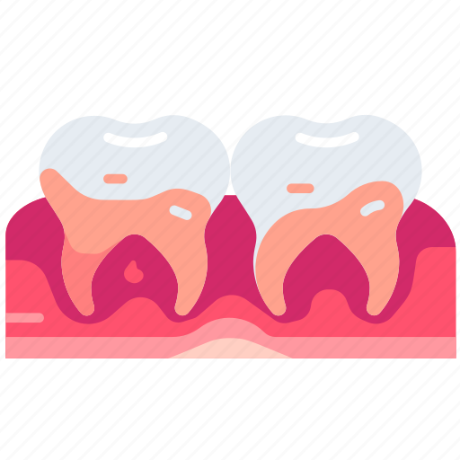 Dentistry, dental, dentist, gingivitis, gum, inflammation, disease icon - Download on Iconfinder