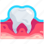 dentistry, dental, dentist, tooth enamel, anatomy, protection, enamel teeth 