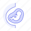 belly, development, fetus, gestation, health, offspring, pregnancy, pregnant 