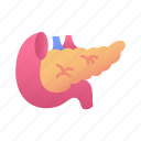 pancreas, anatomy, human, body, organ