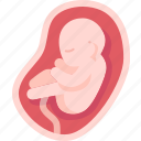 amniotic, fluid, fetus, womb, pregnant