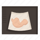baby, maternity, mother, pregnancy, sonogram, ultrasound