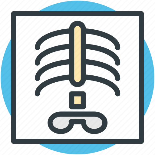 Body part, human ribs, radiology, radioscopy, ribs icon - Download on Iconfinder