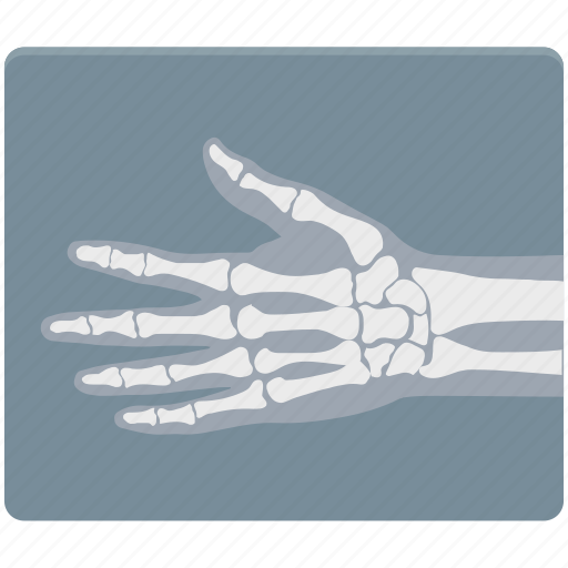 Bons, fitness, hand, hand bons, health, medical icon - Download on Iconfinder