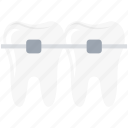 braces, brackets, dental braces, stomatology, teeth braces, teeth support