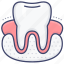 dental, dentist, gum, tooth 