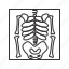 skeleton, death, x ray, bones 
