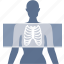 bones, diagnostic, medical, radiography, radiology, skeleton, xray 