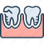 molar silhouette, mouth, orthodontics, prosthesis, silhouette, toothache, treatment 