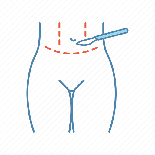 Abdominal, abdominoplasty, lifting, liposuction, plastic surgery, stomach, tummy tuck icon - Download on Iconfinder