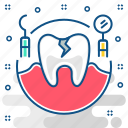 cavity, tooth, dental, dentist, dentistry, rct, root canal
