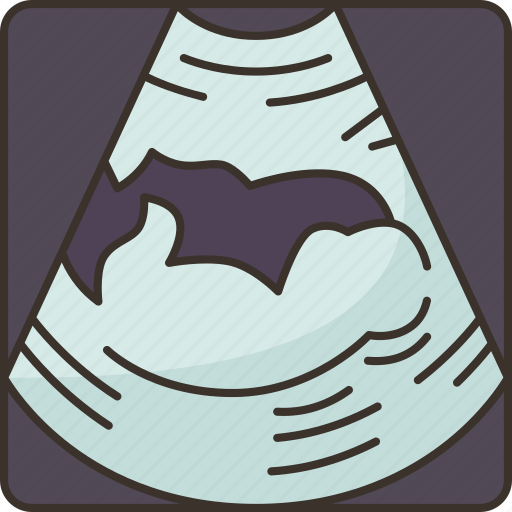 Ultrasound, image, fetus, womb, pregnant icon - Download on Iconfinder