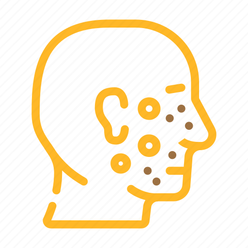 Acne, facial, skin, disease, human, health icon - Download on Iconfinder