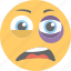 black eye emoji, hurt, ill, sick, sore eye 
