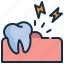 gum, teeth, tooth, mouth, dental, dentistry 