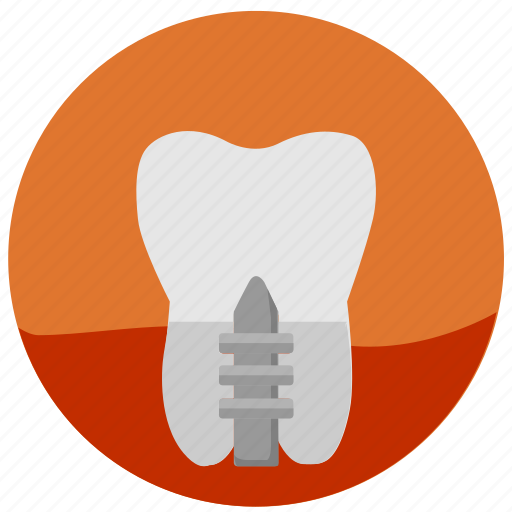 Crown, dental, health, stomatology, tooth, implant, tooth implant icon - Download on Iconfinder