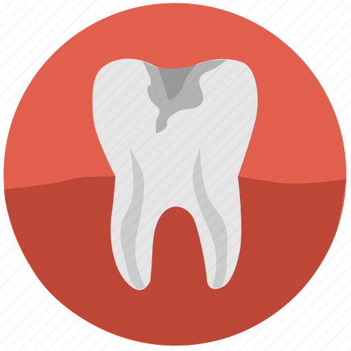 Caries, dental, health, tooth, white, implant, tooth implant icon - Download on Iconfinder
