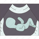 baby, ultrasound, fetus, pregnancy, scan