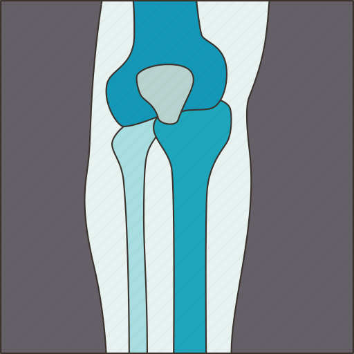 Joint, knee, orthopedic, diagnosis, health icon - Download on Iconfinder