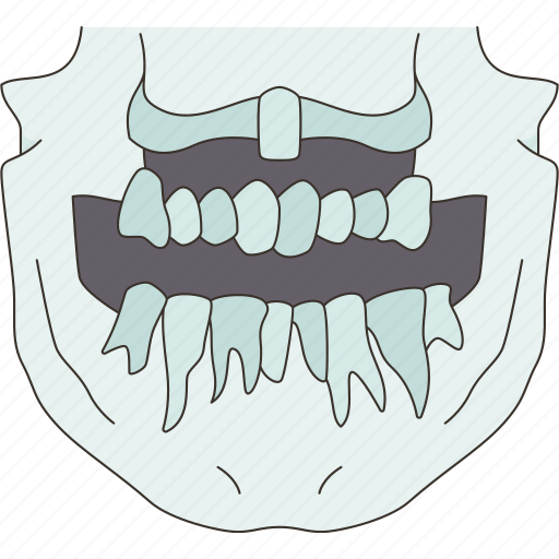 Mouth, teeth, dental, xray, anatomy icon - Download on Iconfinder