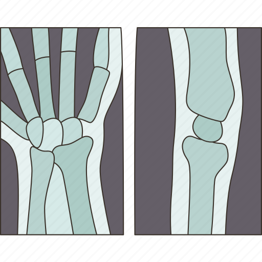 Xray, joint, bones, orthopedic, anatomy icon - Download on Iconfinder