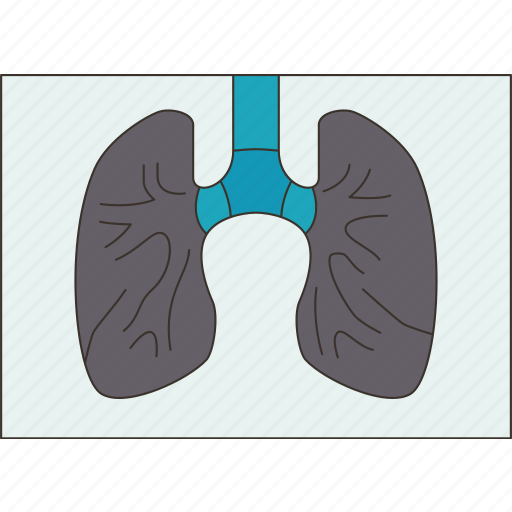 Xray, lungs, respiratory, diagnosis, radiography icon - Download on Iconfinder