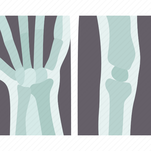 Xray, joint, bones, orthopedic, anatomy icon - Download on Iconfinder